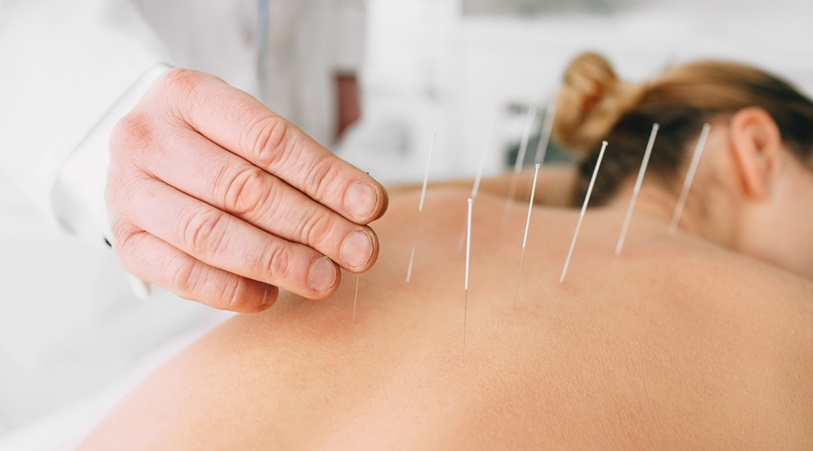 Acupuncture Appointment