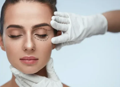 eyelid surgery