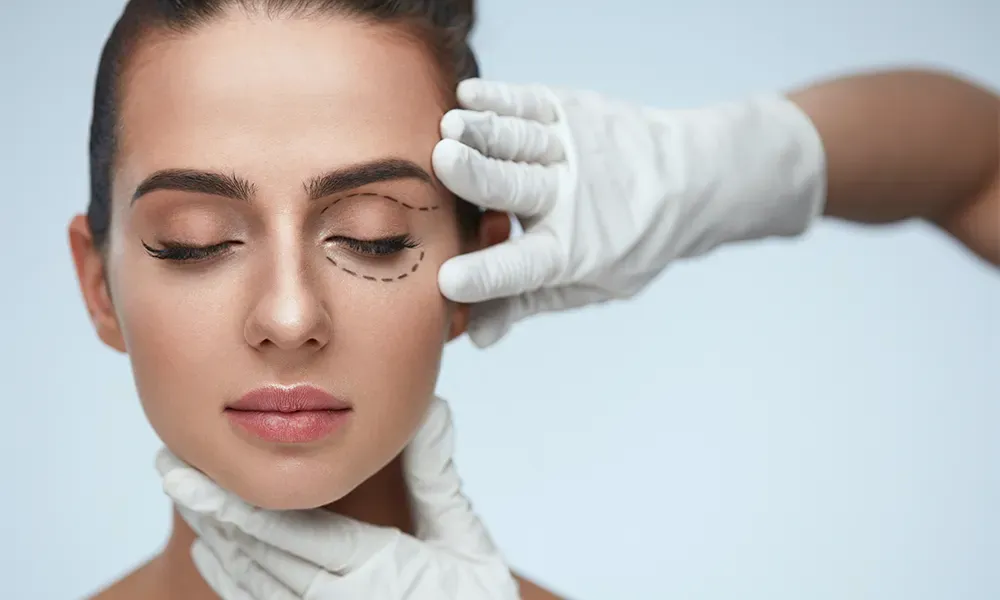 eyelid surgery