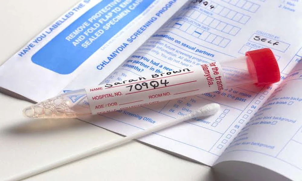 The Best Time to Get Your Flu Vaccine (Most People Miss This)